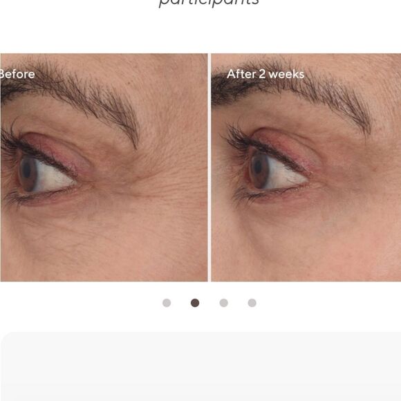 MURAD Retinal ReSculpt Eye Lift Treatment 15ml NEW IN BOX MSRP $92 - Picture 9 of 16